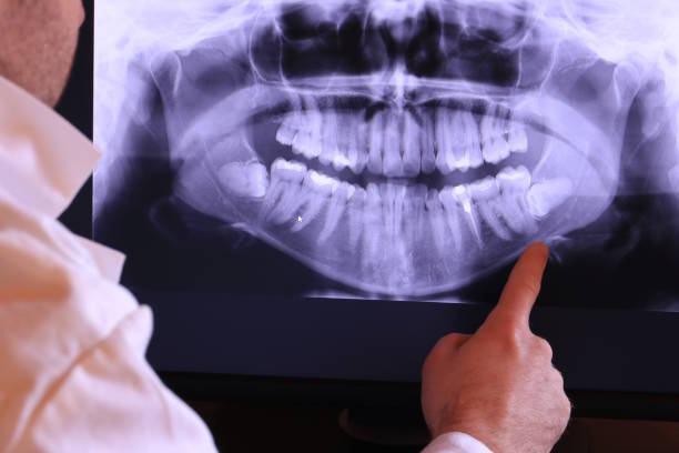 Best Emergency Broken Tooth Repair in Greenlawn, NY