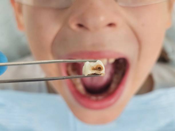 Best Pediatric Emergency Dentist in Greenlawn, NY